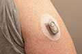 D60 Cured Durometer Hardness Medical Wearable Adhesive