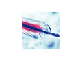 Catheter Adhesives